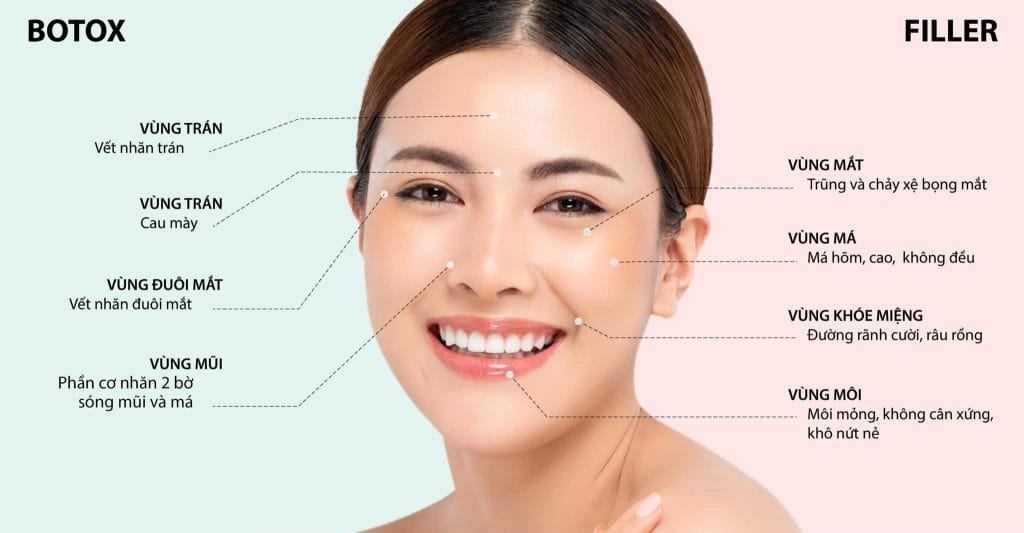 Sự khác nhau giữa tiêm filler và botox