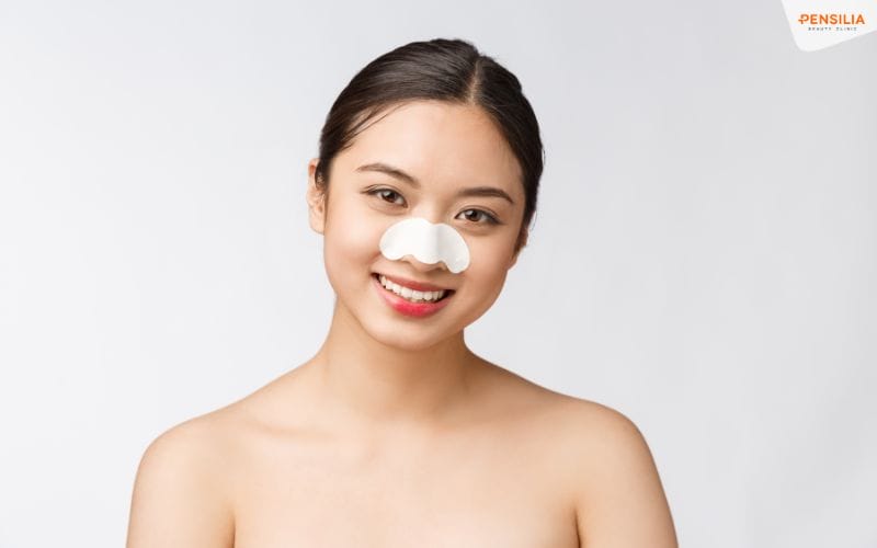lột mụn đầu đen ở mũi