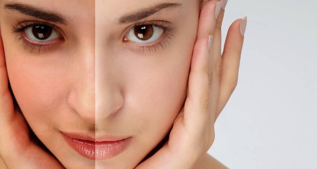 Niacinamide giúp làn da bật tông và đều màu