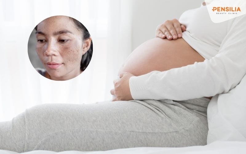 Quá trình mang thai và sinh con làm thay đổi cấu trúc cơ thể và làn da của phụ nữ