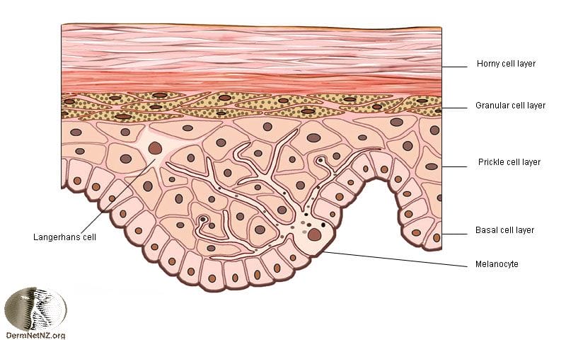 Tăng sắc tố Melanin khiến hình thành sẹo thâm