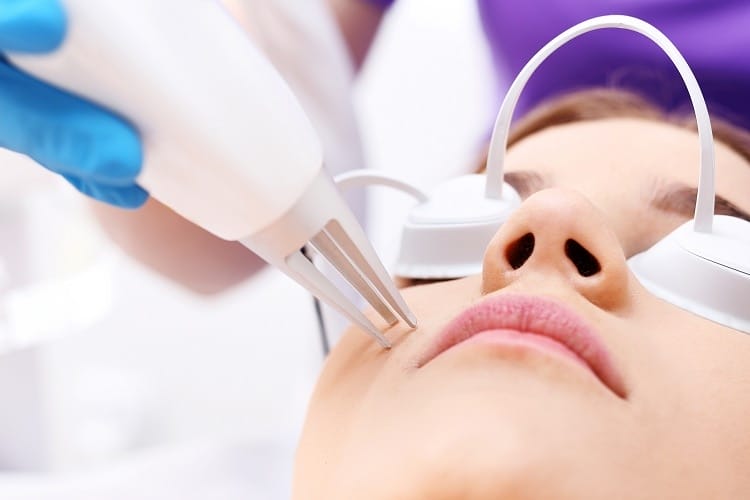 Laser Fractional CO2 giúp thu nhỏ lỗ chân lông