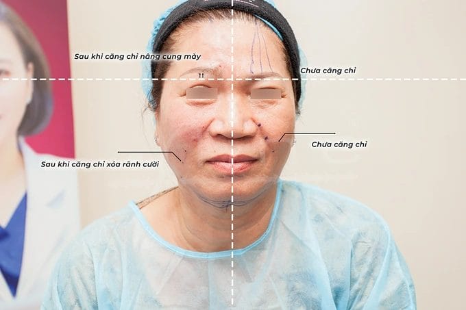 Pensilia biết rằng bạn có rất nhiều sự lựa chọn, cảm ơn bạn lựa chọn và tin yêu dịch vụ tại Pensilia