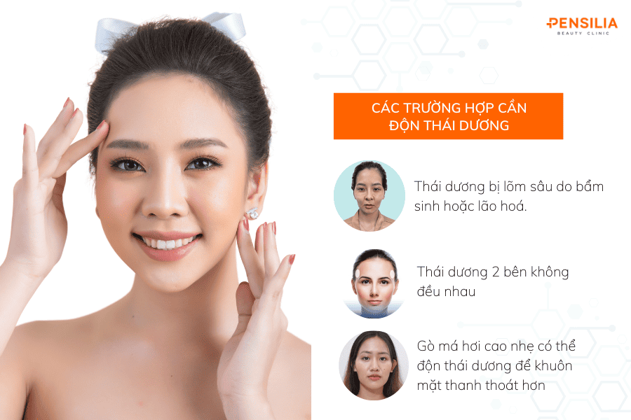 Làm đầy thái dương hóp
