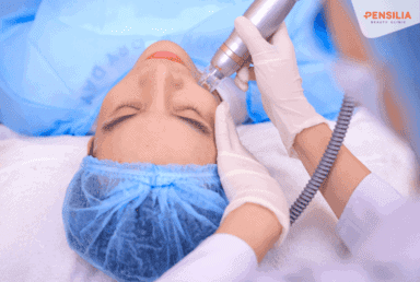 Điều trị nám da tại Pensilia
