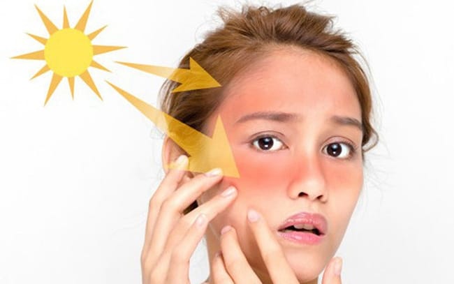 Hạn chế tiếp xúc ánh nắng mặt trời để bảo vệ da