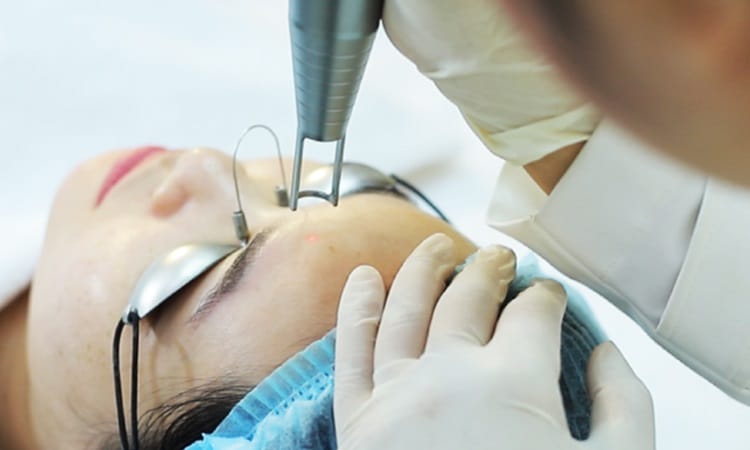 Điều trị nám da tại Pensilia
