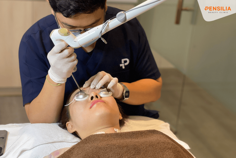 Trị nám da đốm nâu tại Pensilia