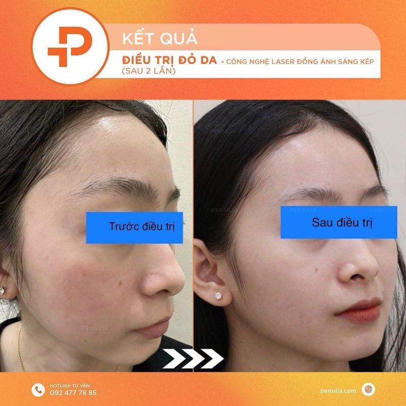 Phục hồi da