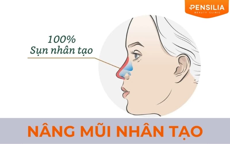 Nâng mũi nhân tạo