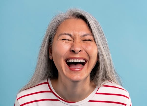 Rãnh cười sâu khi da bị lão hóa