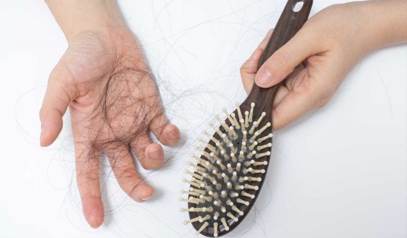 Rụng tóc nhiều là một dạng rụng tóc bệnh lý