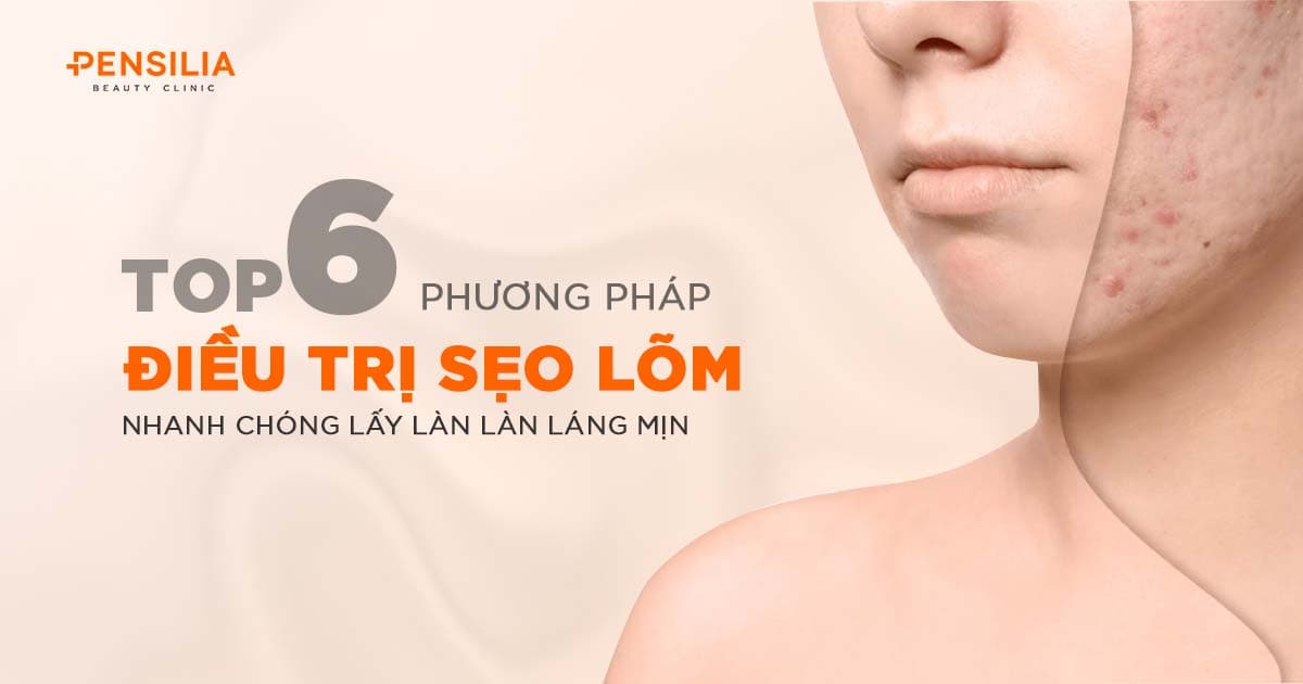 6 phương pháp điều trị sẹo lõm lấy lại làn da sáng mịn