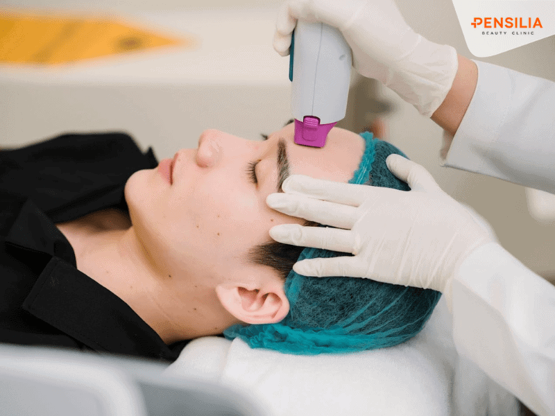 Trẻ hóa, nâng cơ bằng công nghệ sóng RF