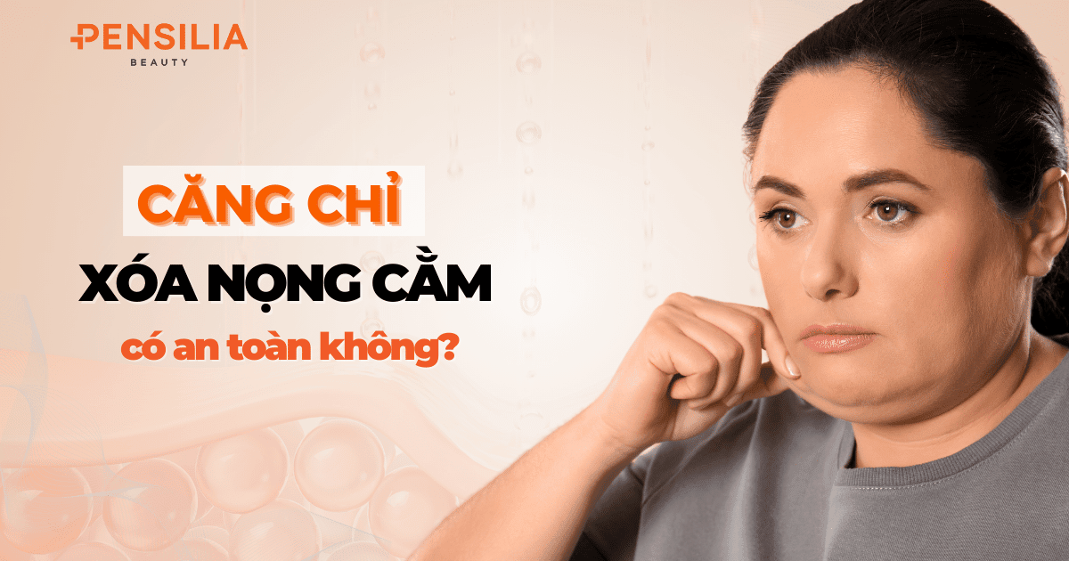 Căng chỉ giảm mỡ, xóa nọng cằm