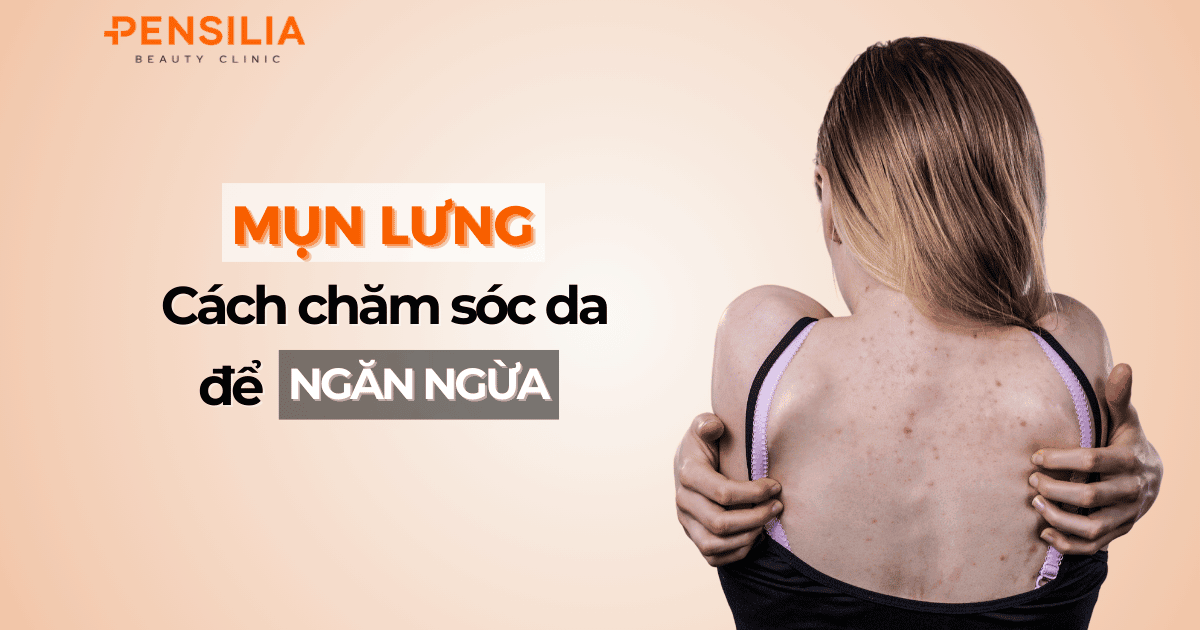 Mụn lưng và cách chăm sóc da hàng ngày để ngăn ngừa
