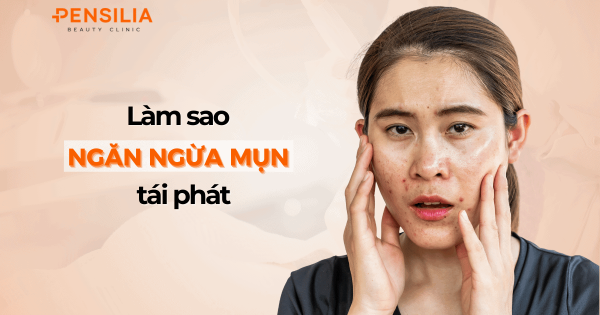 Làm sao để ngăn ngừa mụn tái phát