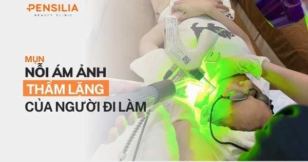 Mụn – Nỗi ám ảnh thầm lặng của người đi làm