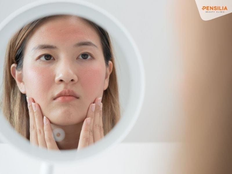 Các hóa chất mạnh có thể làm mỏng da