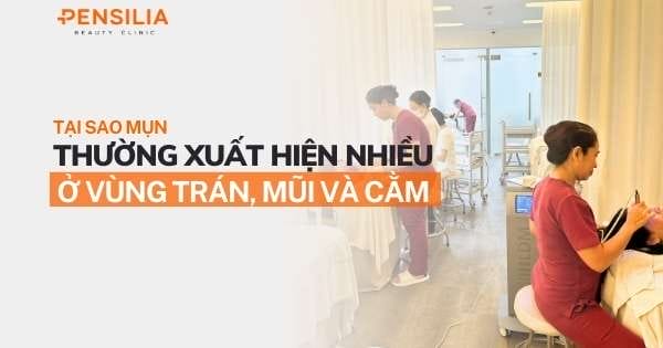 Tại sao mụn thường xuất hiện nhiều ở vùng trán, mũi và cằm?