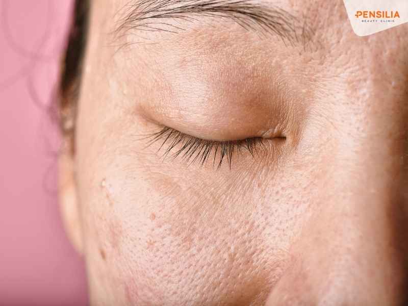 Da xỉn màu, thiếu sức sống