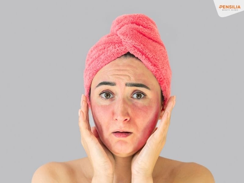 Làn da bị kích ứng, đỏ rộp 