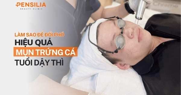 Mụn trứng cá tuổi dậy thì: Làm sao để đối phó hiệu quả?