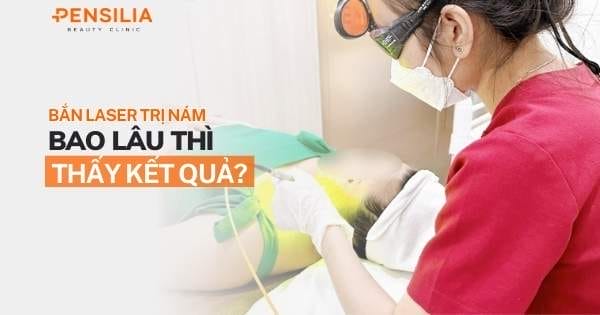 Bắn laser trị nám bao lâu thì thấy kết quả?