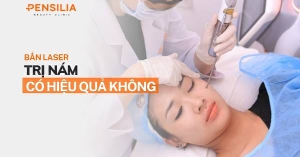 Bắn laser trị nám có hiệu quả không?