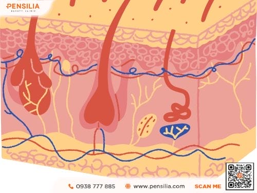 Trị nám bằng laser đồng ánh sáng kép hiệu quả cho nám da có tăng sinh nội mô mạch máu